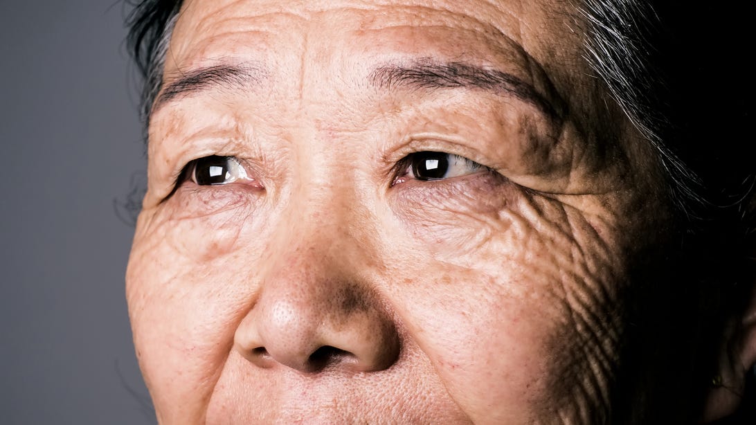 Eye Health and Older Age: How These 6 Conditions May Become More Common